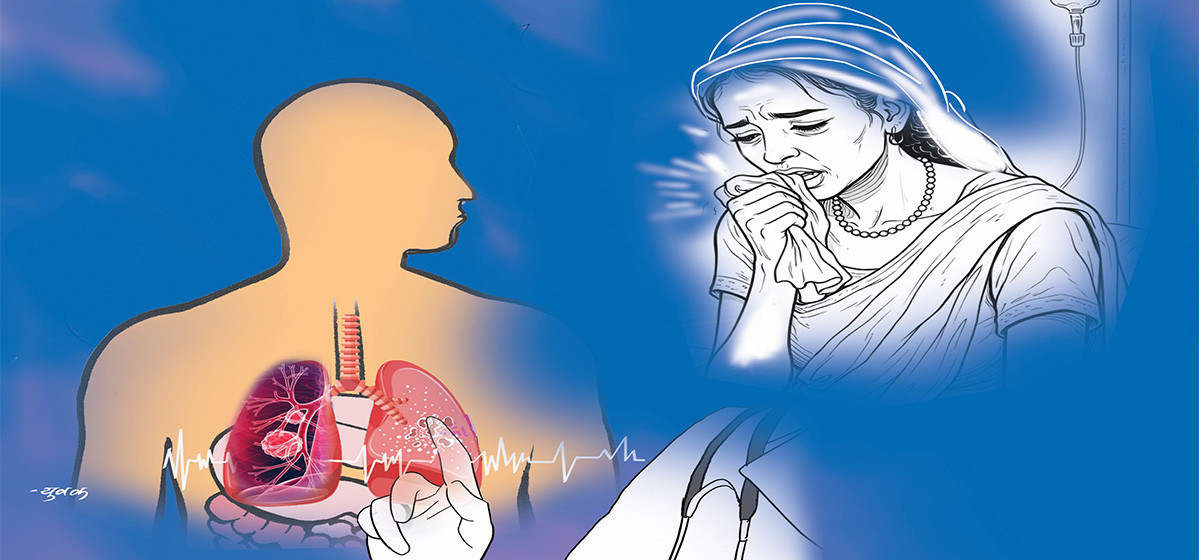 नेपालमा क्षयरोग अझै चुनौती, वार्षिक हजारौँ संक्रमित